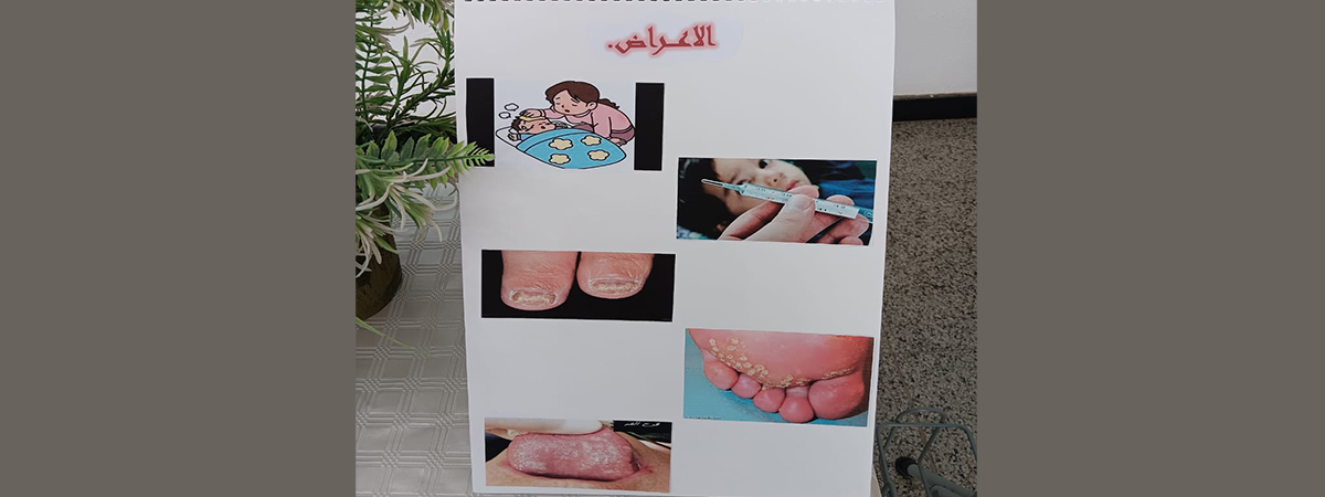 فعالية “التوعية بمكافحة الإيدز”